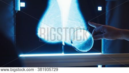 Breast Cancer Prevention. Doctor Examines Mammogram Snapshot Of Breast Of Female Patient On The Moni