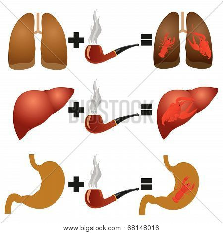 Disease from smoking