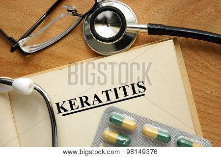 Word  Keratitis. Medical concept.