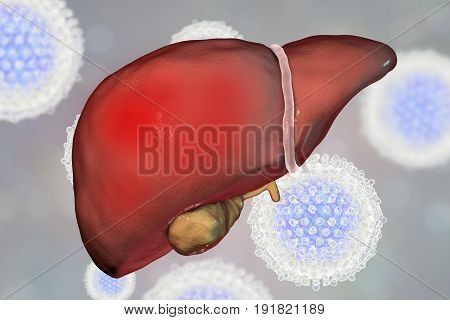 Liver with Hepatitis C infection surrounded by Hepatitis C Viruses HCV, 3D illustration