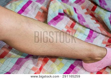 Woman And Her Hairy Leg On A Multi-colored Towel. Girl In Anticipation Of Procedures Of Depilation B