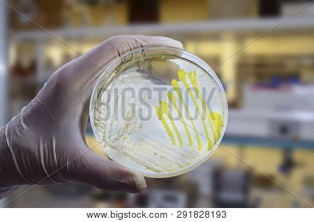 Colonies Of Different Bacteria And Mold Fungi Grown On Petri Dish With Nutrient Agar, Close-up View.