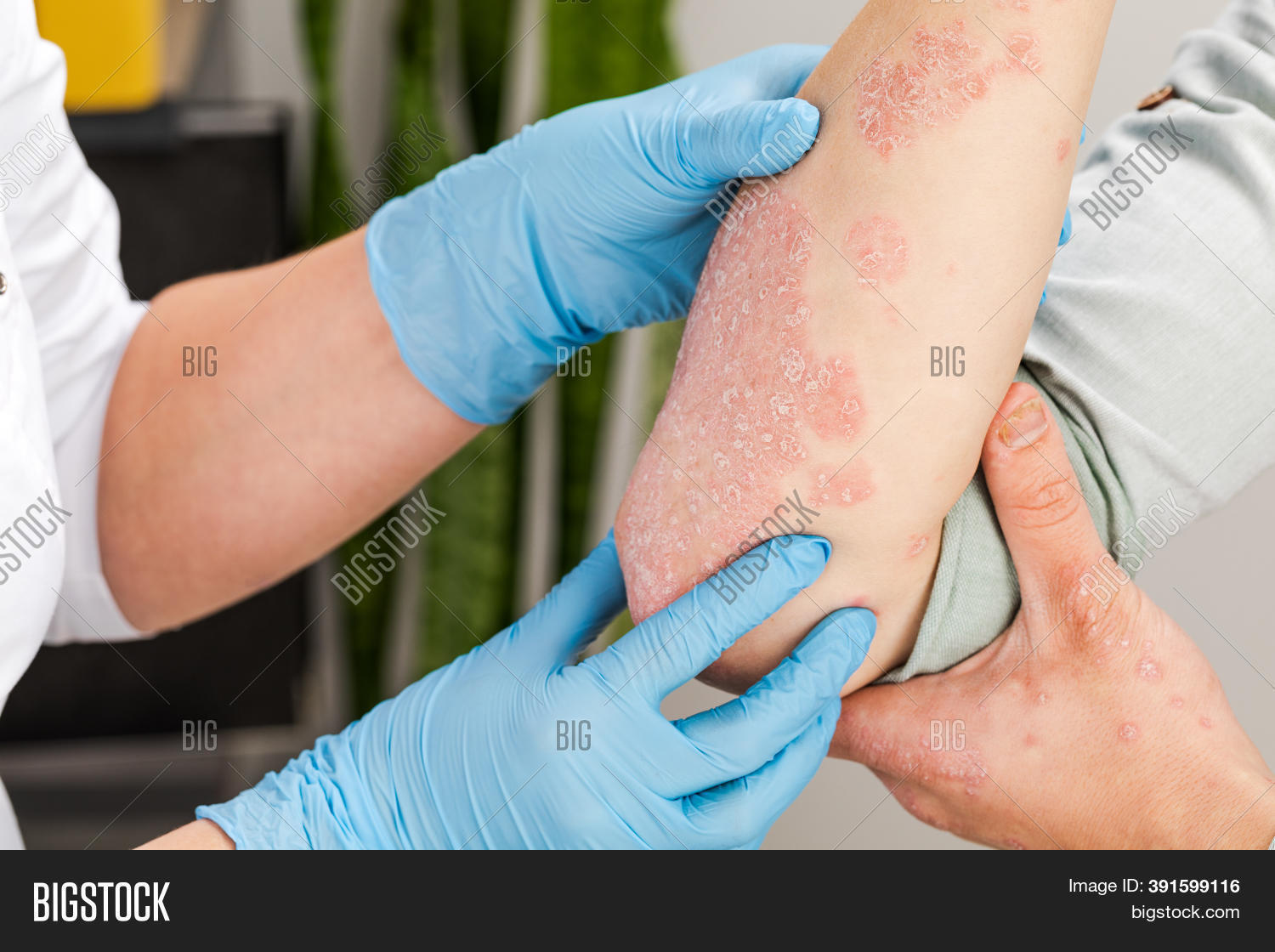 Dermatologist Wearing Image Photo Free Trial Bigstock