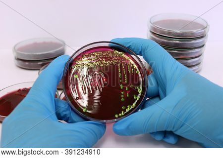 Scientist Analysis Escherichia Coli (e.coli) With Eosin Methylene Blue (emb) Agar In Petri Dish Drop