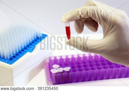 Micro Centrifuge Tube With Blood Sample In Solution Handle In Scientist Hand Wear Surgical Gloves, W