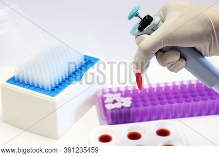 Scientist Transfers Blood Sample Into Micro Centrifuge Tubes By Using Micropipette Handle In Hand, W