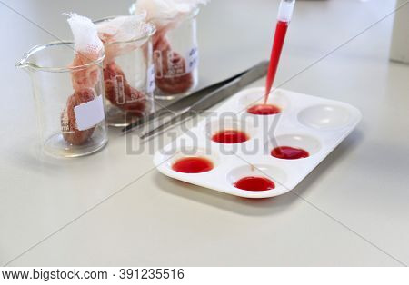 Scientist Transfers Blood Sample Into Plate And Micro Centrifuge By Using Micropipette, With Tip Mic