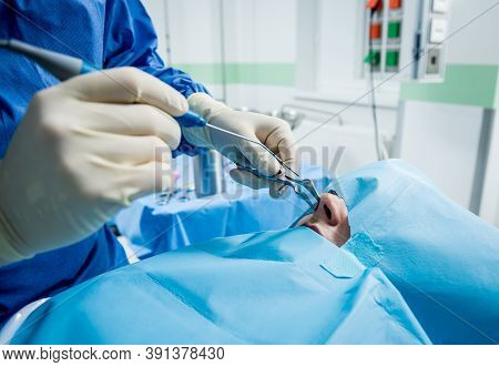 Functional Rhinosurgery To Restore Nasal Breathing With Coblation Technology.