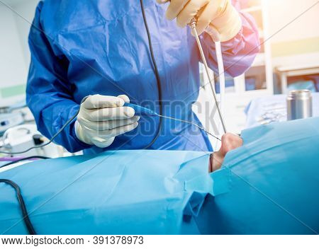Functional Rhinosurgery To Restore Nasal Breathing With Coblation Technology.