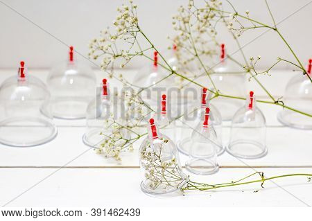 Jars For Hijama On A White Wooden Background And White Flowers. Bloodletting. Sunnah Treatment. Isla