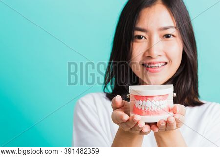 Portrait Of Asian Teen Beautiful Young Woman Smile Have Dental Braces On Teeth Laughing She Holding 