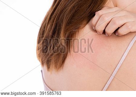 Female Scratching Her Back Isolated White Background. Medical, Healthcare For Advertising Concept.