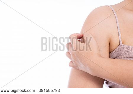 Female Scratching Her Arm Isolated White Background. Medical, Healthcare For Advertising Concept.