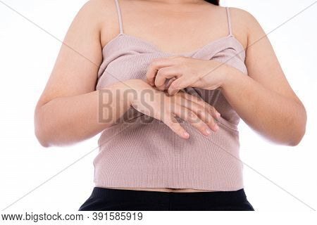 Female Scratching Her Hand Isolated White Background. Medical, Healthcare For Advertising Concept.