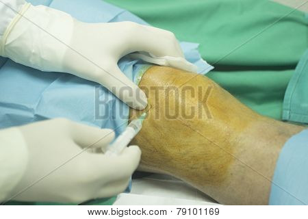Surgeon And Male Patient Injection Human Growth Factors