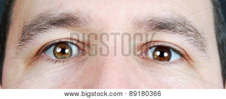 Heterochromia Iridum