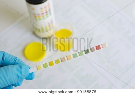 Urine analysis