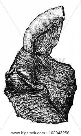 Intussusception of the Intestine, vintage engraved illustration. Usual Medicine Dictionary by Dr Labarthe - 1885
