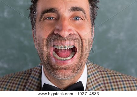 Nerd silly retro man with braces funny expression open mouth