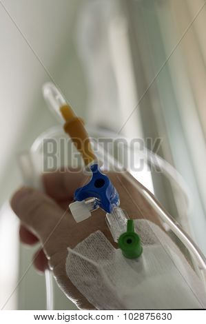 Catheterization On Arm