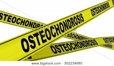 Osteochondrosis. Yellow Warning Tapes With Black Words Osteochondrosis (orthopedic Diseases). Isolat