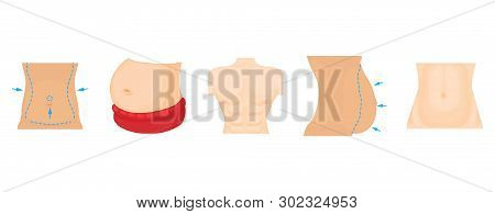 Abdomen Icon Set. Cartoon Set Of Abdomen Icons For Web Design Isolated On White Background