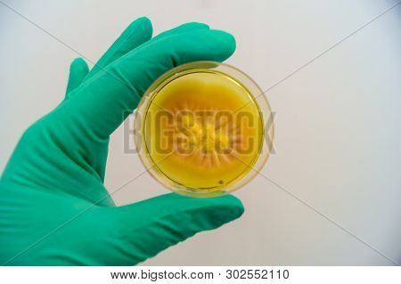 Mold Grown On A Sabouraud Agar Medium In A Petri Dish.