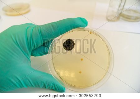 Mold Grown On A Sabouraud Agar Medium In A Petri Dish.