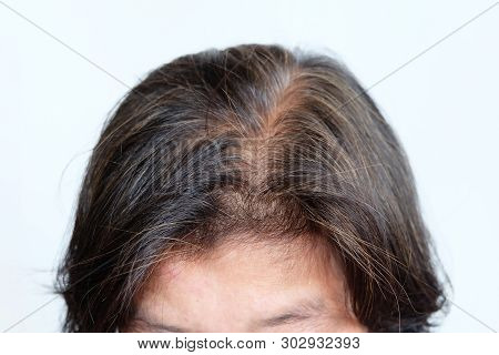 Close Up Gray Hair Or Hoary Hair Of Elderly Asian Woman On A White Background