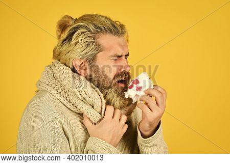 Stuffed Nose. Brutal Man Runny Nose. Epidemic Concept. Guy Blow Out Nose In Paper With Blood. Allerg