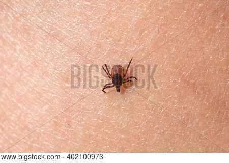 Tick Crawling On Human Hand - Borrelia Disease Concept