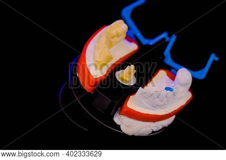 Automatic 3d Dental Scanner For Dental Gypsum Model Scanning And Measuring With Rotating Platform - 