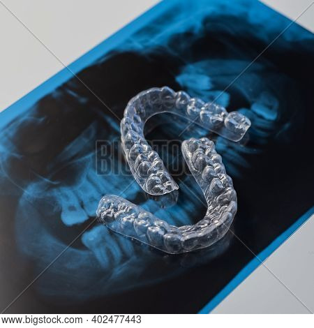 Transparent Bite Correction Trays And X-ray Of The Jaw. Orthodontist Equipment