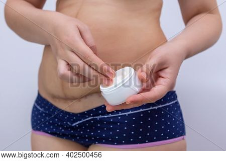 A Woman After Giving Birth Smears Ointment On The Scar From A Caesarean Section