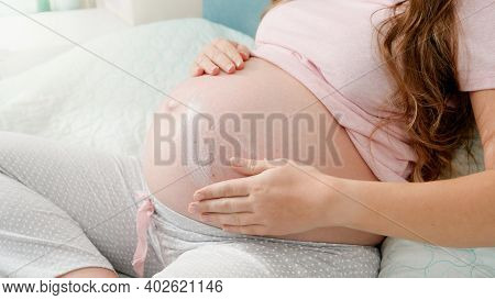 Closeup Of Pregnant Woman Applying Moisturizing Creme Against Stretch Marks On Big Belly. Concept Of