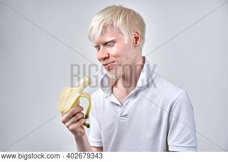Albinism Albino Man White Skin Hair Studio Dressed T-shirt Isolated White Background. Abnormal Devia