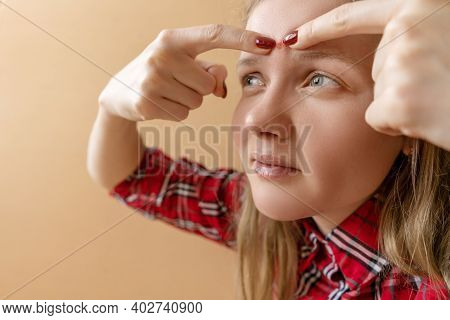 Woman Presses Pimple On Her Forehead With Her Finger, Close-up. Problem Skin, Concept Portrait.