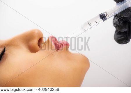 Lip Augmentation Procedure With Hyaluronic Acid. The Beautician Pierces The Lips With A Needle. Subc
