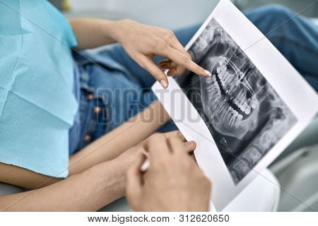 Pretty Womans Teeth Treatment In Dental Clinic