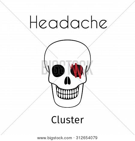 Headache Linear Icon. Vector Abstract Minimal Illustration Of Skull With Red Zigzag On The Head Suff