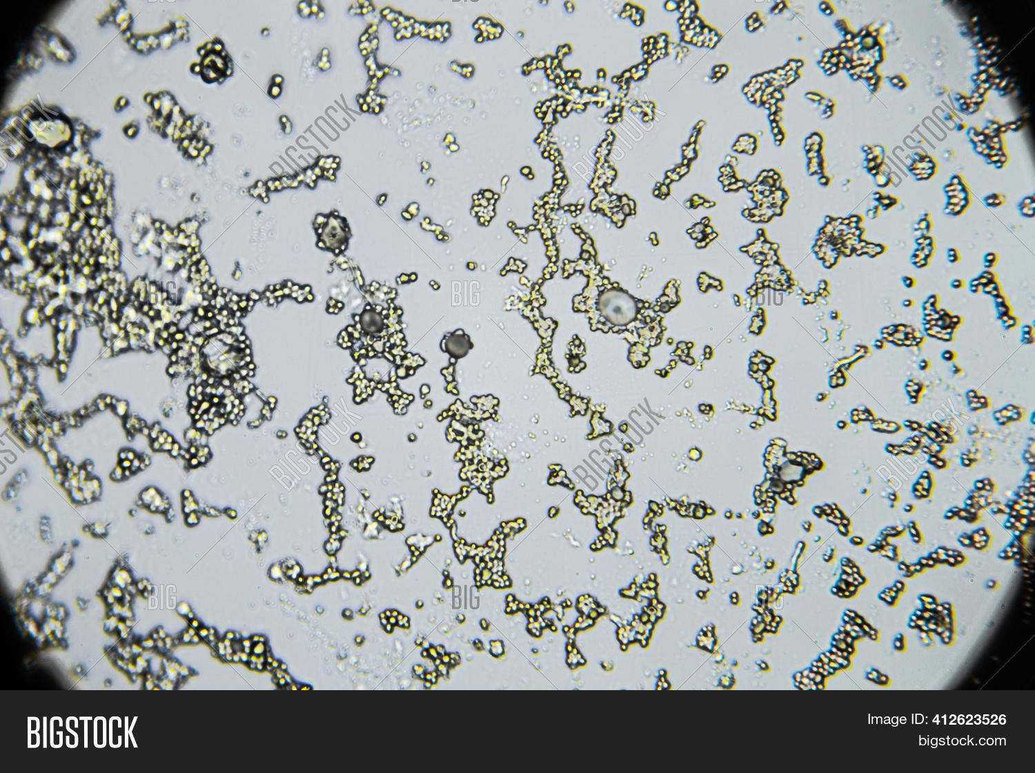 Mold Spores Under Image & Photo (Free Trial) Bigstock