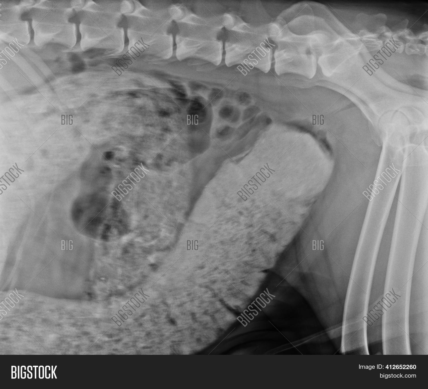 Abdominal X Ray Image & Photo (Free Trial) Bigstock