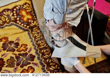 The Prosthetist Removes The Measure From A Person With A Disability, Man With Amputee.