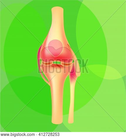 Medical Illustration Of Realistic Joints, Vector, Isoalted On The Green