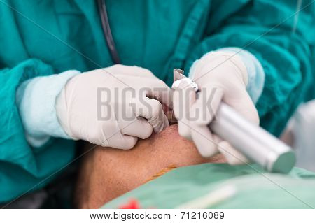 Apply Laryngoscope Blade For Insert Endotracheal Tube