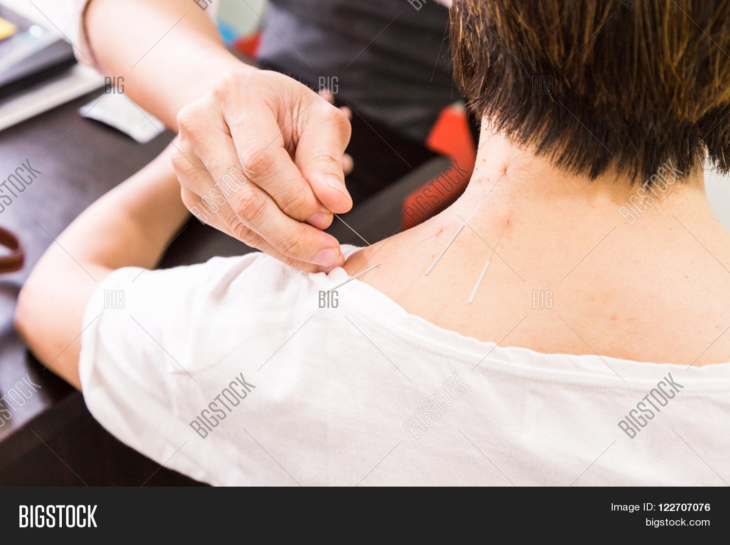 Иголка. Корпоральная иглорефлексотерапия. Иглотерапия коленного сустава. Иглы для пирсинга стерильные 15g. Африканский кистехвостый дикобраз.