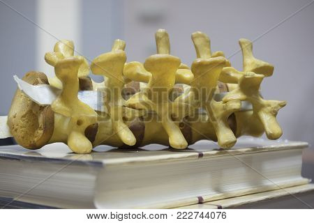 Lumbar spine model on medical textbook in doctor office