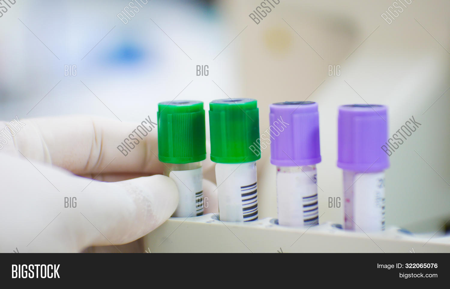 Edta Purple Test Tube Image & Photo (Free Trial) Bigstock