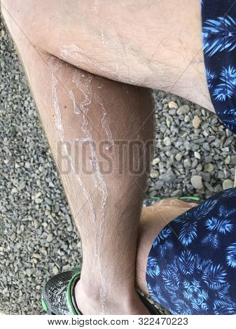 A Man In Rubber Slippers Extended His Legs. Covered With Salt After Swimming In The Salt Water Pool.