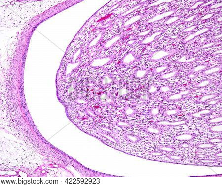 Kidney. Renal Papilla And Kidney Pelvis. Calyx Of The Renal Pelvis(left) Lined By Transitional Epith